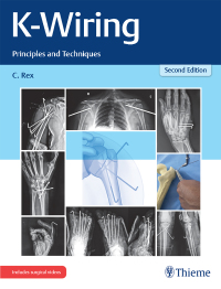 Cover image: K-Wiring 2nd edition 9789390553624