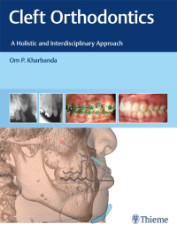 Cover image: Cleft Orthodontics 1st edition 9788194857082