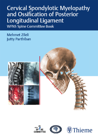 Cover image: Cervical Spondylotic Myelopathy and Ossification of Posterior Longitudinal Ligament 1st edition 9789390553204