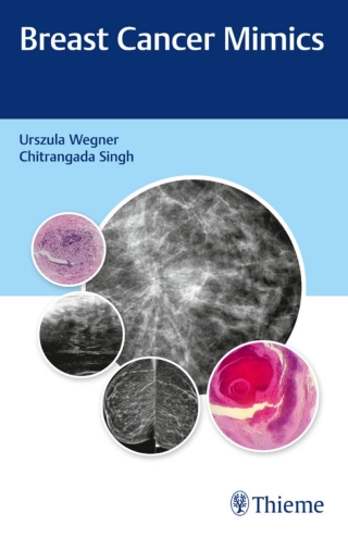 表紙画像: Breast Cancer Mimics 1st edition 9789388257947