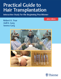 Cover image: Practical Guide to Hair Transplantation 1st edition 9789390553242