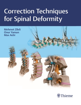 Cover image: Correction Techniques for Spinal Deformity 1st edition 9789395390101