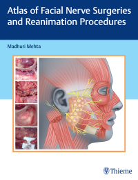 Imagen de portada: Atlas of Facial Nerve Surgeries and Reanimation Procedures 1st edition 9789392819131