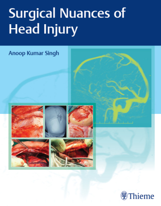 Cover image: Surgical Nuances of Head Injury 1st edition 9789395390248