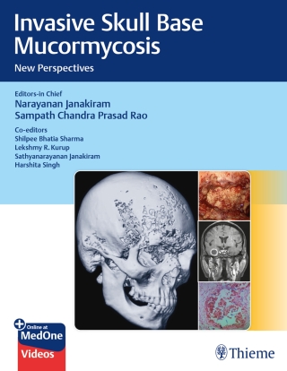 Omslagafbeelding: Invasive Skull Base Mucormycosis 1st edition 9789395390316