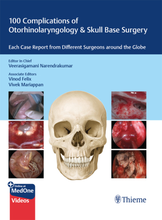 Omslagafbeelding: 100 Complications of Otorhinolangyngology & Skull Base Surgery 1st edition 9789395390576
