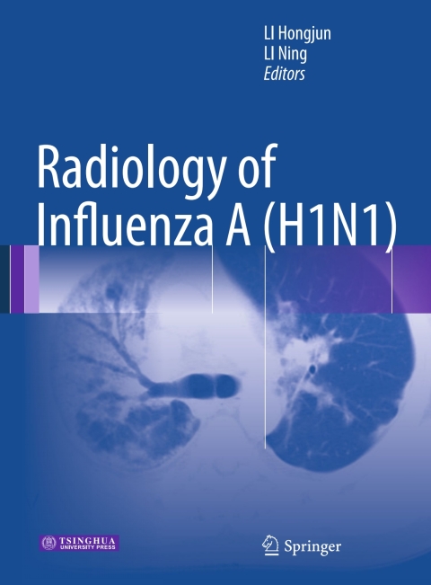 Radiology of Influenza A (H1N1) - FULL INSTANT DOWNLOAD | PDF DOCX EPUB