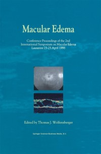 Cover image: Macular Edema 1st edition 9780792364412