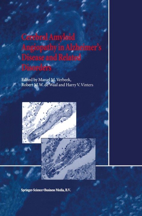 Cerebral Amyloid Angiopathy in Alzheimer’s Disease and Related Disorders, 1st Edition - FULL INSTANT DOWNLOAD | PDF DOCX EPUB
