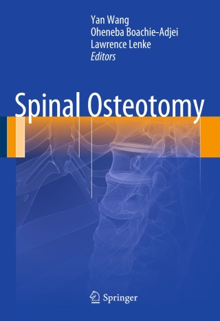 Imagen de portada: Spinal Osteotomy 9789401780377