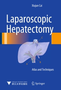 Cover image: Laparoscopic Hepatectomy 9789401798396