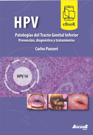 Cover image: HPV, Patologías del Tracto Genital Inferior 1st edition 9789509124585