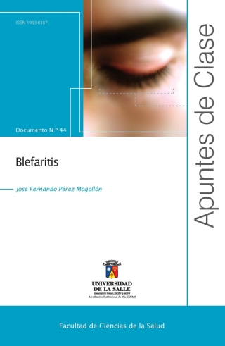 Omslagafbeelding: Blefaritis 1st edition 9789585136533
