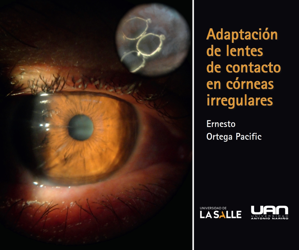 Adaptación de lentes de contacto en córneas irregulares 1st Edition
