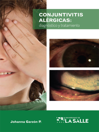 Cover image: Conjuntivitis alérgicas: Diagnóstico y tratamiento 1st edition 9789588939230