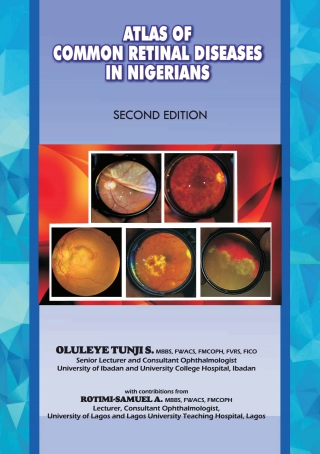 Cover image: The Atlas of Retinal Diseases in Nigerians 9789789212088