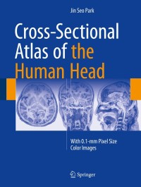 Omslagafbeelding: Cross-Sectional Atlas of the Human Head 9789811007699