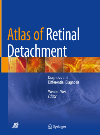 Cover image: Atlas of Retinal Detachment 9789811082306
