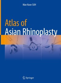 صورة الغلاف: Atlas of Asian Rhinoplasty 9789811086441