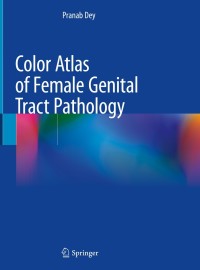 Immagine di copertina: Color Atlas of Female Genital Tract Pathology 9789811310287