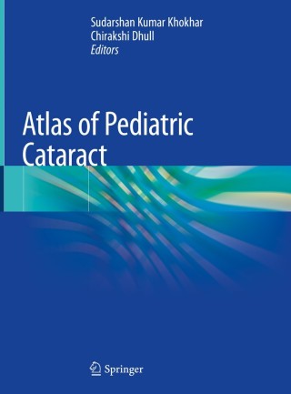 表紙画像: Atlas of Pediatric Cataract 9789811369384