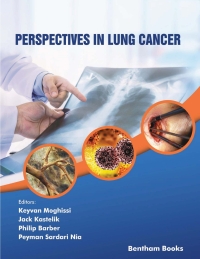 Cover image: Perspectives in Lung Cancer 1st edition 9789811459542