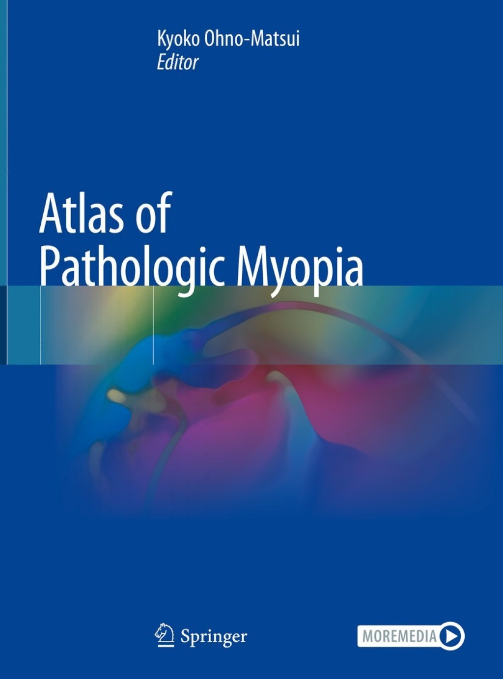 Atlas of Pathologic Myopia 1st Edition