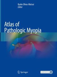 Imagen de portada: Atlas of Pathologic Myopia 1st edition 9789811542602