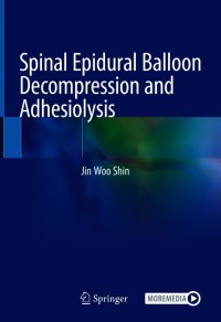 表紙画像: Spinal Epidural Balloon Decompression and Adhesiolysis 9789811572647
