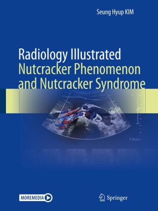 Imagen de portada: Radiology Illustrated: Nutcracker Phenomenon and Nutcracker Syndrome 9789811662171