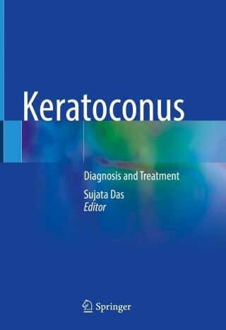 Cover image: Keratoconus 9789811942617