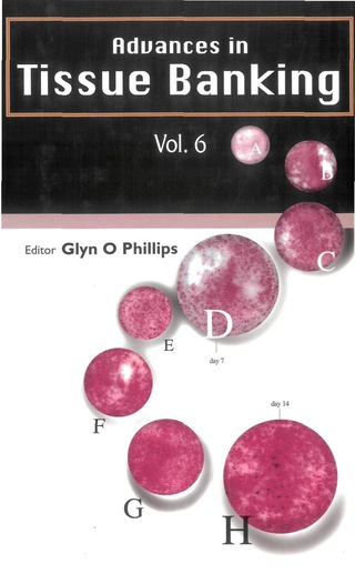 Cover image: ADVANCES IN TISSUE BANKING (V6) 9789812380883