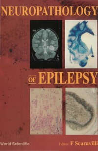 表紙画像: Neuropathology Of Epilepsy 9789810231705