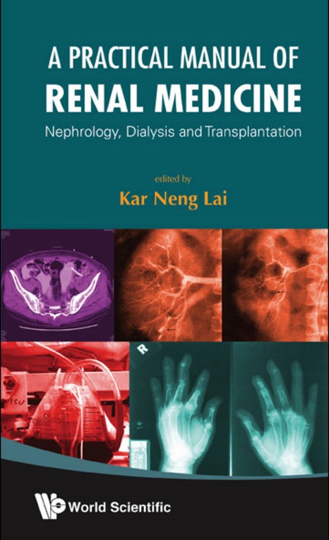 A Practical Manual of Renal Medicine: Nephrology, Dialysis And Transplantation - FULL INSTANT DOWNLOAD | PDF DOCX EPUB