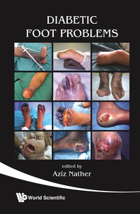 Cover image: DIABETIC FOOT PROBLEMS 9789812791528