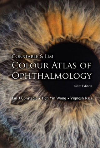 Cover image: Constable & Lim Colour Atlas of Ophthalmology 6th edition 9789813236615