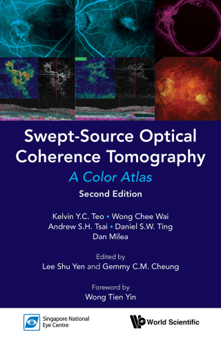 Cover image: Swept-Source Optical Coherence Tomography: A Color Atlas 2nd edition 9789813271777
