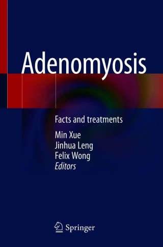 Imagen de portada: Adenomyosis 9789813340947