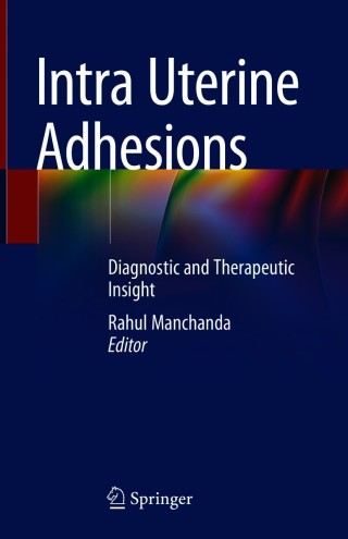 Cover image: Intra Uterine Adhesions 1st edition 9789813341449
