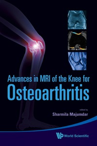 Imagen de portada: Advances In Mri Of The Knee For Osteoarthritis 9789814271707