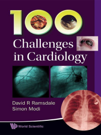 Omslagafbeelding: 100 CHALLENGES IN CARDIOLOGY 9789814307147