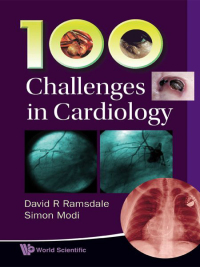 表紙画像: 100 CHALLENGES IN CARDIOLOGY 9789814307147