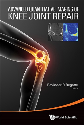 Cover image: Advanced Quantitative Imaging of Knee Joint Repair 9789814579322
