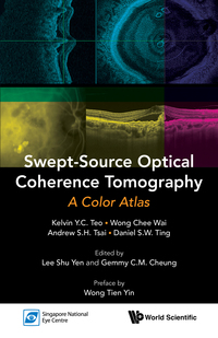 Omslagafbeelding: SWEPT-SOURCE OPTICAL COHERENCE TOMOGRAPHY: A COLOR ATLAS 9789814704212