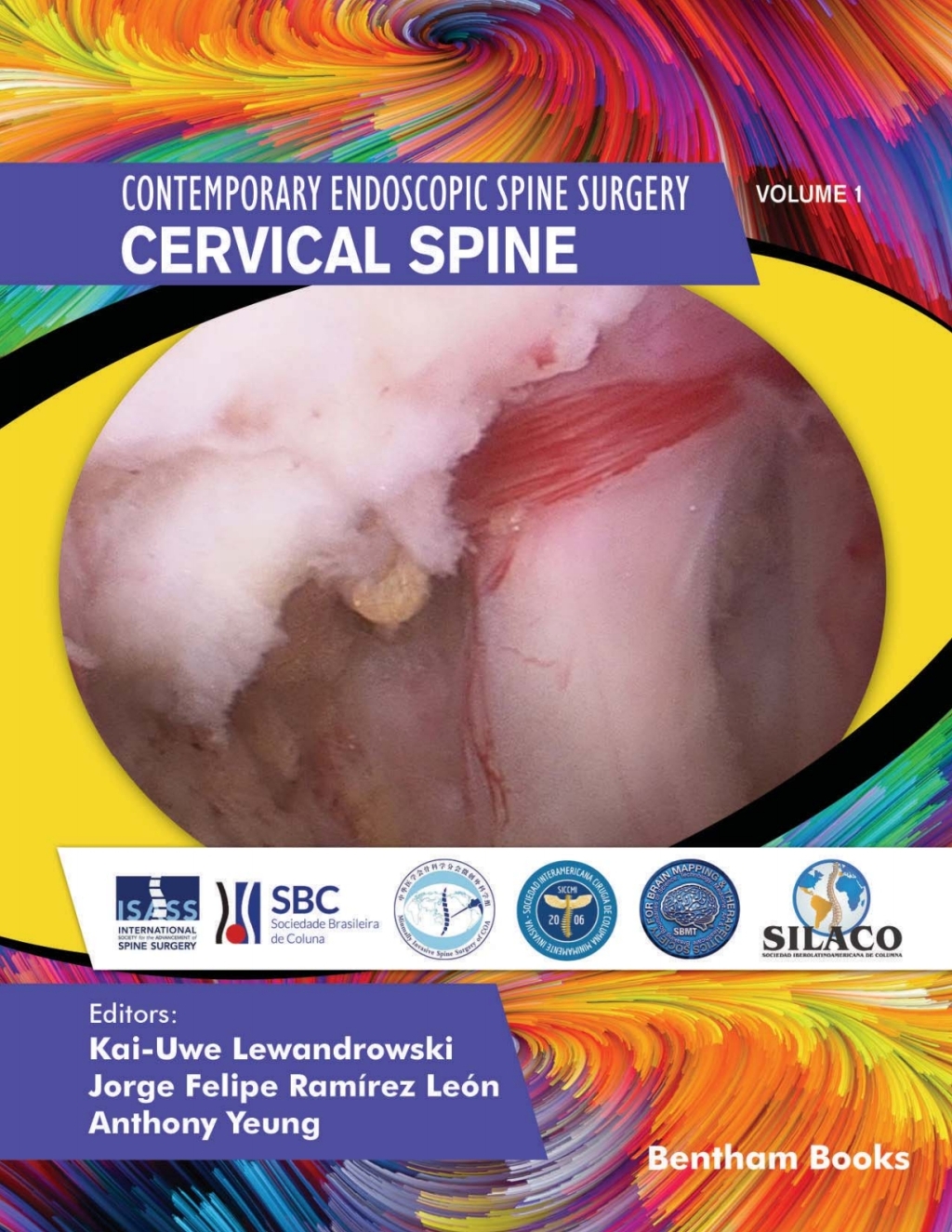 Contemporary Endoscopic Spine Surgery Volume 1: Cervical Spine 1st Edition