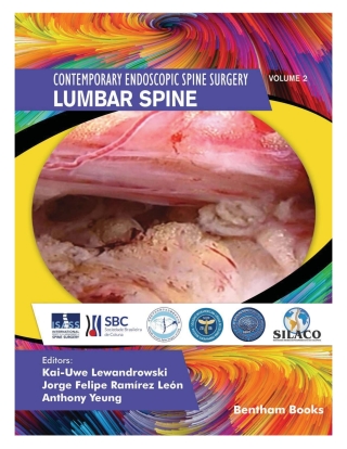 Cover image: Lumbar Spine 1st edition 9789815051520