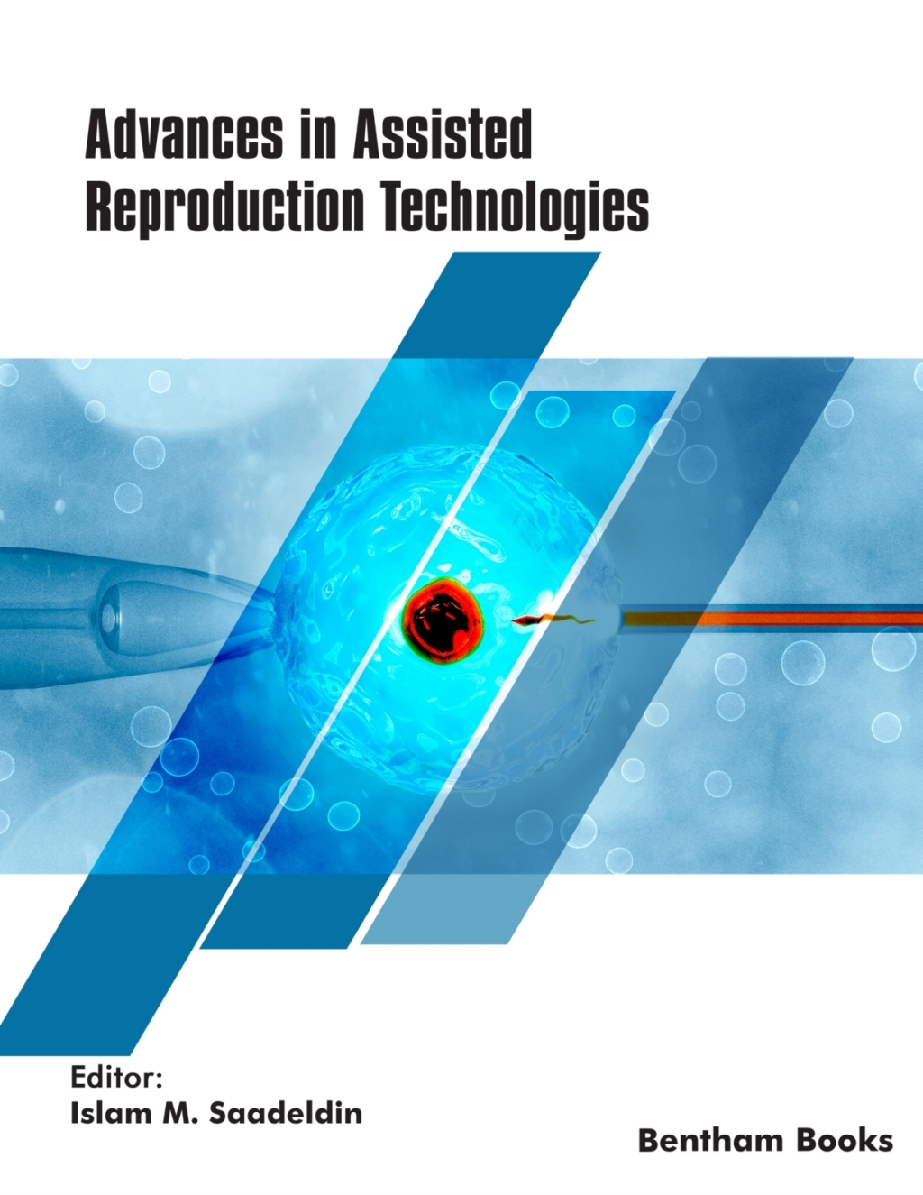 Advances in Assisted Reproduction Technologies 1st Edition