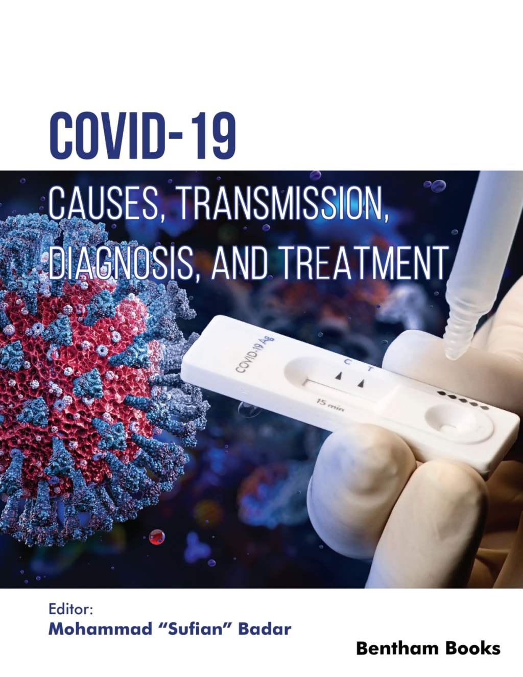 COVID-19: Causes Transmission Diagnosis and Treatment - 1st Edition (eBook)