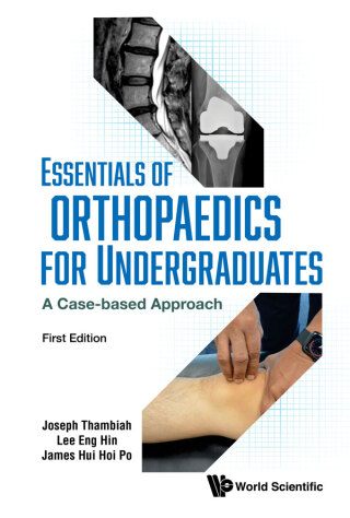 Cover image: ESSENTIALS OF ORHTOPAEDICS FOR UNDERGRADUATES 9789819800377