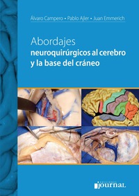 صورة الغلاف: Abordajes neuroquirúrgicos al cerebro y la base del cráneo 1st edition 9789871259786